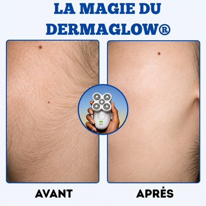 Une peau douce et lisse. Sans les contraintes du rasoir classique