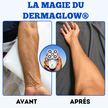 Une peau douce et lisse. Sans les contraintes du rasoir classique