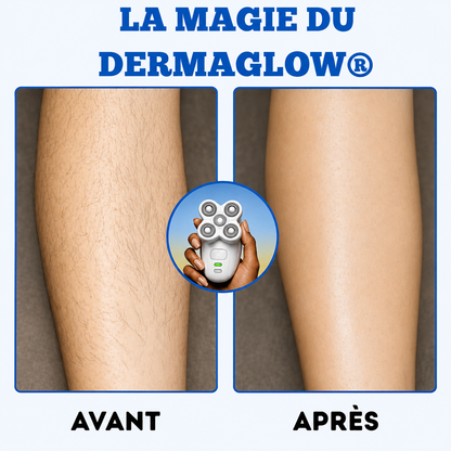 Une peau douce et lisse. Sans les contraintes du rasoir classique